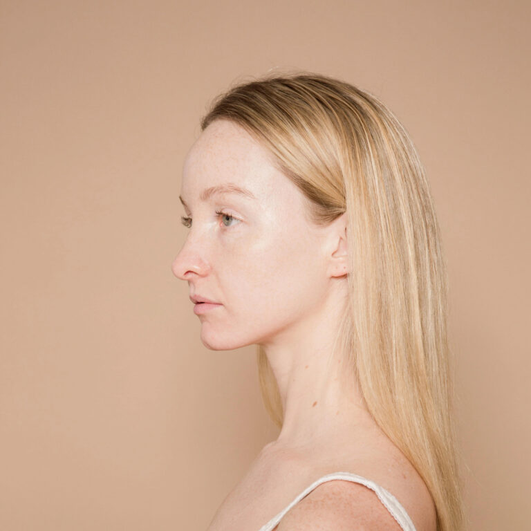 Boynunuzdaki Şişlikler (Bezeler) Ne Zaman Kanser Belirtisidir?